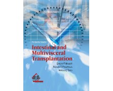 Intestinal and Multivisceral Transplantation