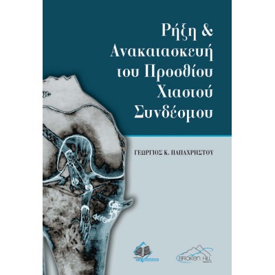 Ρήξη και Ανακατασκευή του Πρόσθιου Χιαστού Συνδέσμου